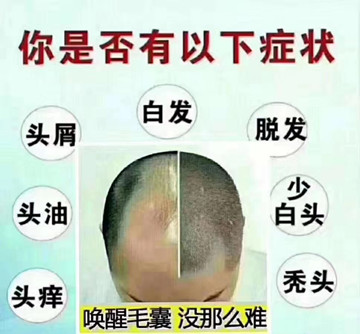秀丝顿植物养发馆加盟之关于保持黑发的小窍门