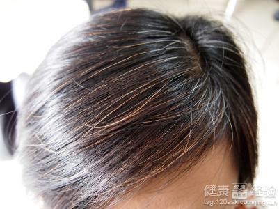 秀丝顿植物养发馆加盟之白发用什么染发最安全