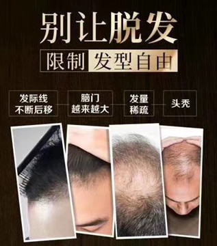 秀丝顿植物养发馆加盟之洗发不要过于频繁