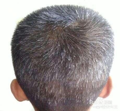 秀丝顿植物养发馆加盟之白发产生的原因