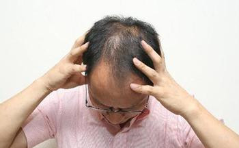 秀丝顿植物养发馆加盟之选择秀丝顿有加盟优势