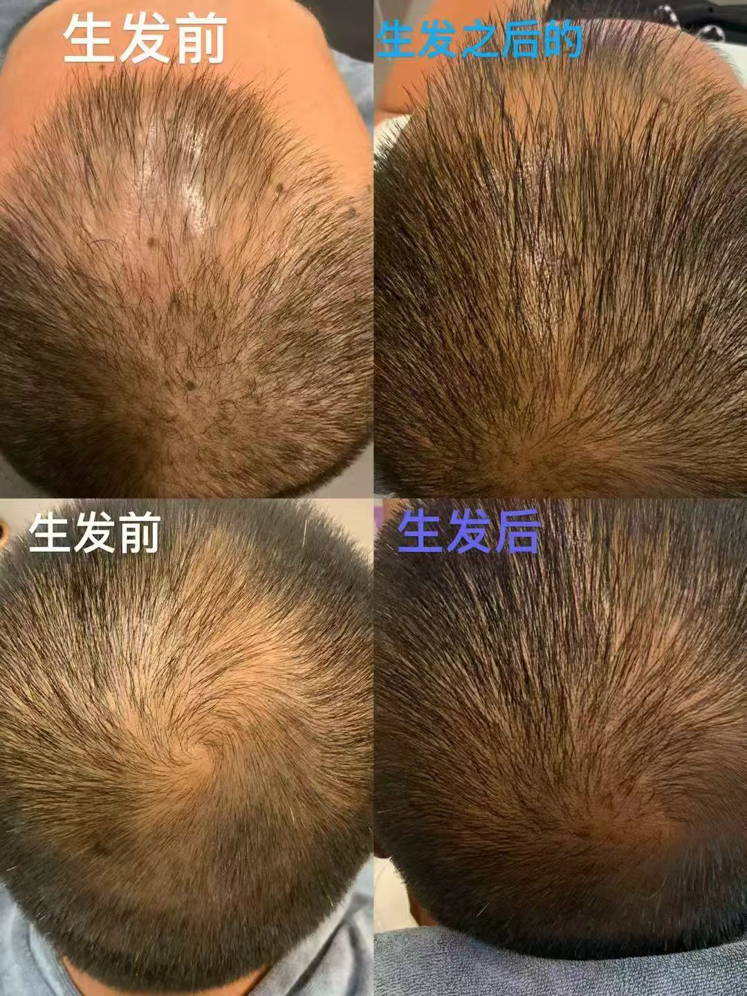 生发效果