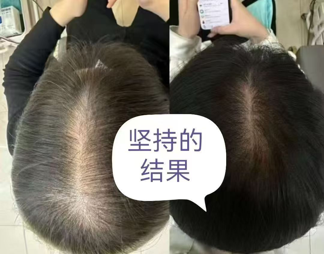 生发效果