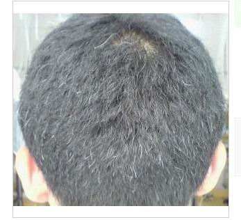 秀丝顿植物养发馆加盟之养发妙招轻松养出乌黑秀发