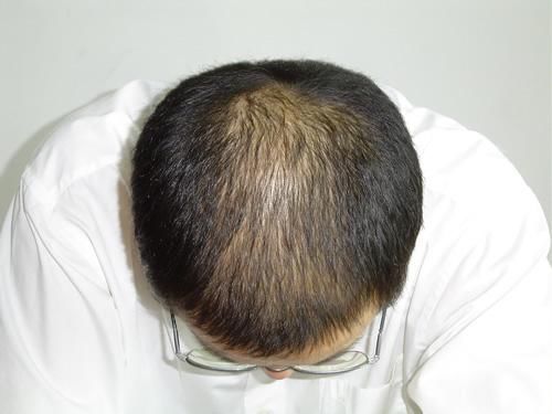 养发馆加盟怎么做？养发馆加盟，就选秀丝顿！