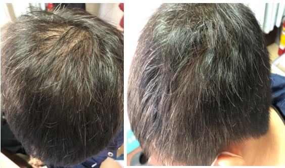 秀丝顿植物养发馆加盟之为什么植物染发要连续做四次