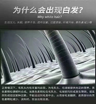 秀丝顿植物养发馆加盟之白发转黑的原理