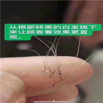 秀丝顿植物养发馆加盟之头疗养发馆经营管理有哪些误区？
