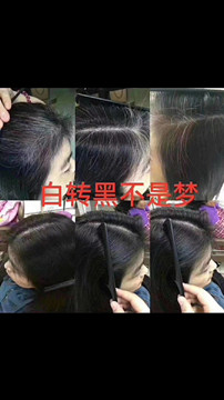 秀丝顿植物养发馆加盟之白发转黑是真的吗？​