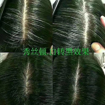 秀丝顿植物养发馆加盟之灰白发